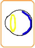 Diabetes India - How can diabetes affect the eye?