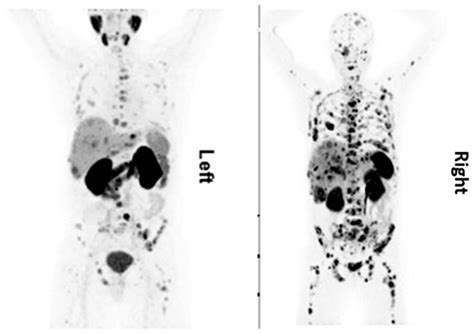 Target Heterogeneity in Oncology: The Best Predictor for Differential ...
