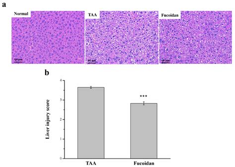 The Ameliorative Effects of Fucoidan in Thioacetaide-Induced Liver ...