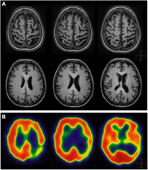 Alien Hand Sign 的图像结果