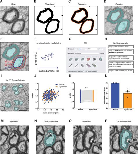 MyelTracer: A Semi-Automated Software for Myelin g-Ratio Quantification | eNeuro
