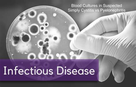 Blood Cultures in Suspected Simple Cystitis vs Pyelonephritis — NUEM Blog