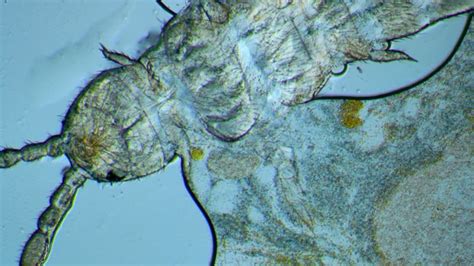 Image result for Spring Tails Bugs Under Microscope