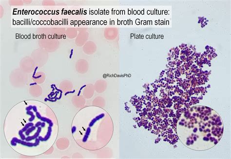 Image result for Enterococcus Faecalis Bacteria Cell Structure