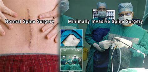 Online Spine Doctor Consultation in Jaipur, Online Back Pain Doctor ...