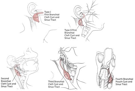 CT Case 095 • LITFL • CT scan interpretation