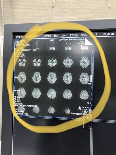 Computer Science DTI 的图像结果