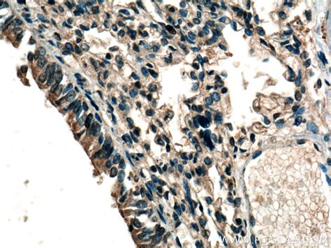 RDM1 antibody (20156-1-AP) | Proteintech