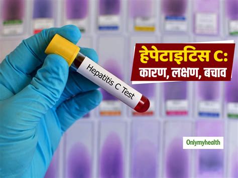 Symptoms, Causes and Tips to Prevent Hepatitis C In Hindi | जानें ...