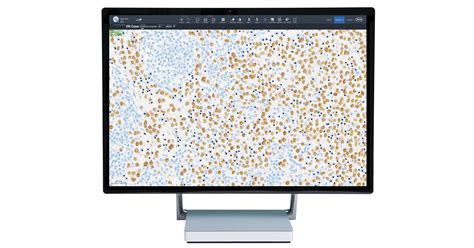 Roche announces the release of its newest artificial intelligence based digital pathology ...