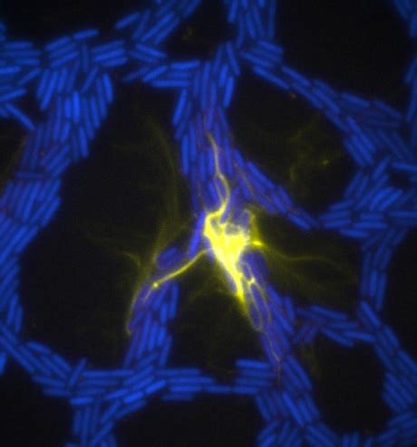 Image result for Big Exploding Infections