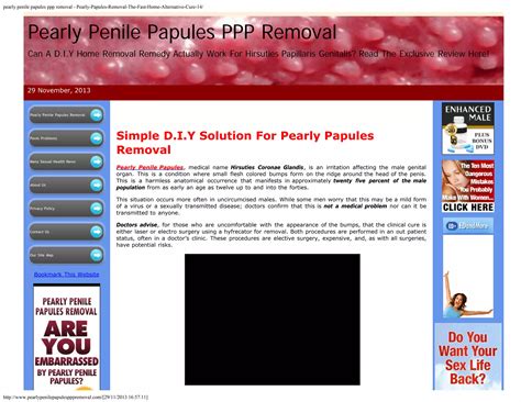 pearly papules removal the fast home alternative cure | PDF