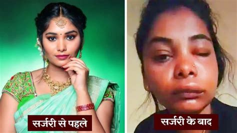 दांत की इस सर्जरी से बिगड़ गया एक्ट्रेस का चेहरा, आप जरूर रखें इन बातों ...