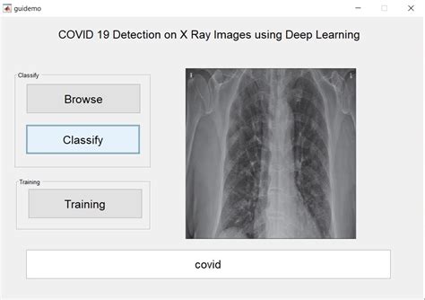 MATLAB Coronavirus 的图像结果