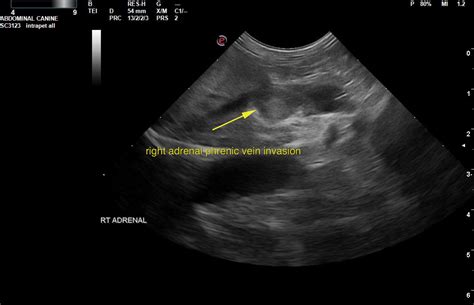 Bilateral adrenal gland masses with phrenic vein invasion in a 12 year old FS Bichon Frise - Members