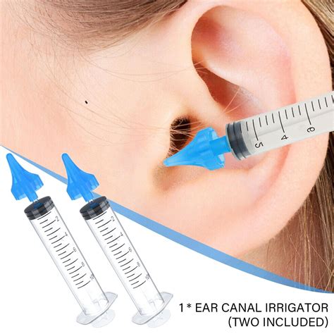 Ear Wax Removal Bristol at Christopher Bryant blog
