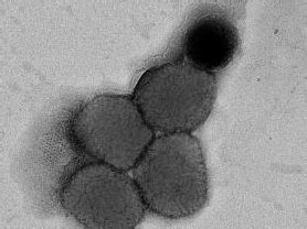 北京发现两例猴痘病例，均为亲密接触感染！疾控最新提示→_动物_传播_世卫组织