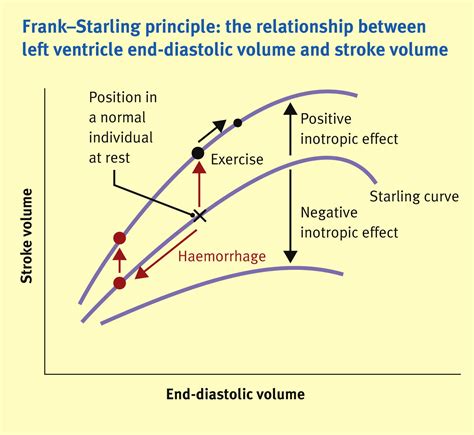 The cardiac cycle - Anaesthesia & Intensive Care Medicine