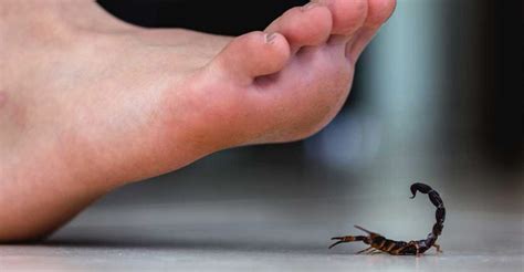 Scorpion Sting: Causes, Symptoms, Scorpion Sting Treatment & Prevention