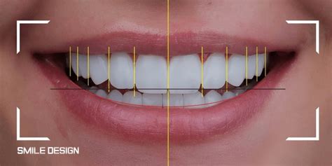 Image result for Teeth Computer