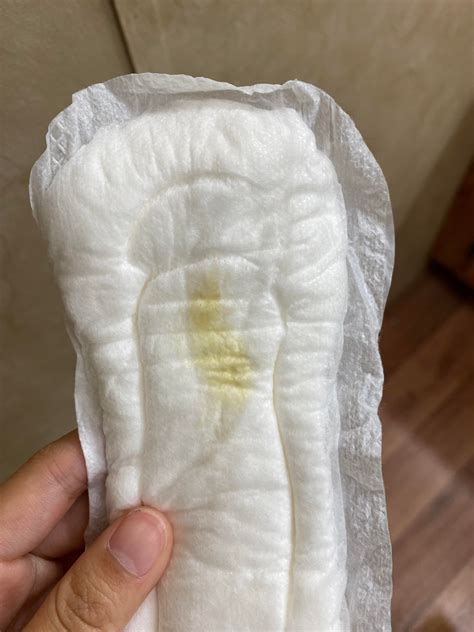 Yellow Green Discharge Female