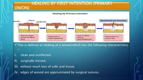 Mechanism of wound healing ppt | PPTX