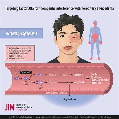 Hereditary Angioedema Hereditary Angioedema | World Allergy