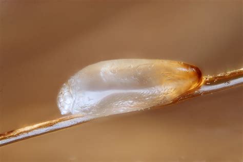 Head Lice (Pediculosis Capitis) | Nits | Geeky Medics