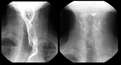 Radioloksabha - Articles