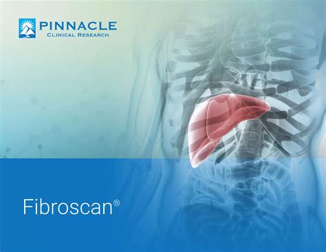 What is Fibroscan? | PDF