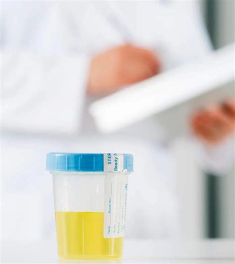 Normal Urine Output Calculator