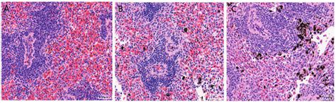 Transcriptomic and Proteomic Analyses of the Immune Mechanism in ...