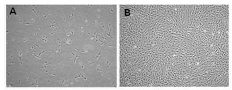 Human Adipose Mesenchymal Stem Cells Millipore