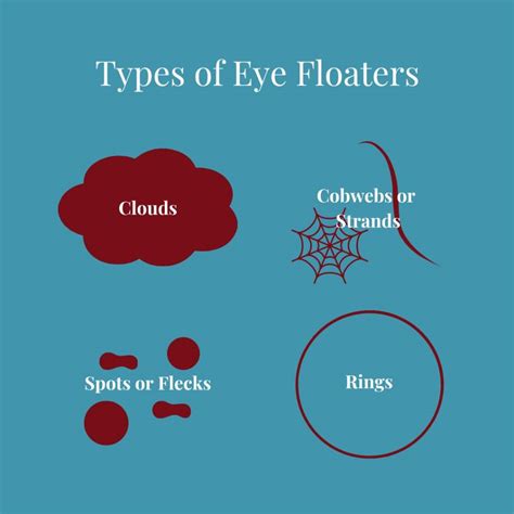 What Causes Eye Floaters? (And What to Do About Them)