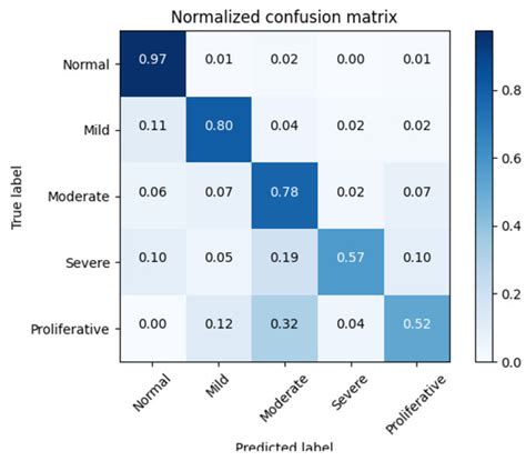 Multi-Scale Feature Fusion with Adaptive Weighting for Diabetic ...