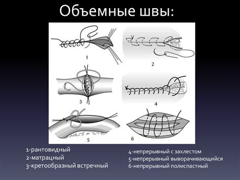Швы, используемые в хирургической стоматологии. Техника наложения ...