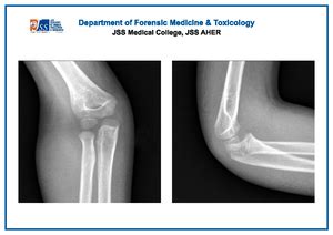FM x ray chart -03 - ray imaging - JSS Jss ACADEMY OF HIGHER EDUCATION ...