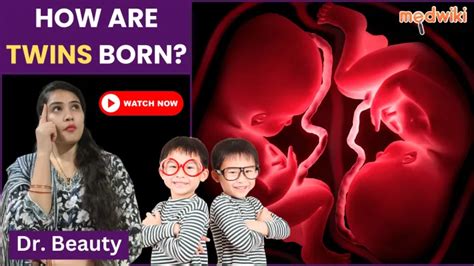 Cause of pregnancy with twins| How are twins born? | Video | Medwiki
