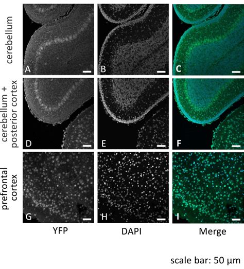 Image result for Intrathecal Injection Mouse