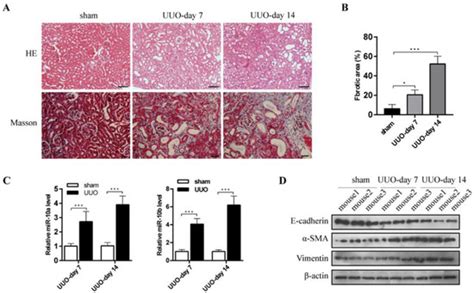 MicroRNA-10 Family Promotes the Epithelial-to-Mesenchymal Transition in ...