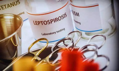 Yale researchers develop novel test for leptospirosis