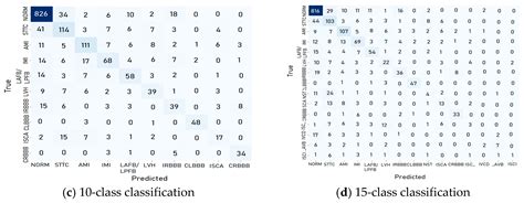 Interpretable Deep Learning Models for Arrhythmia Classification Based ...