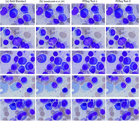 Image result for Cell Segmentation Methods