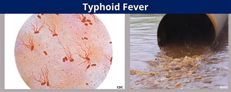 Step Ladder Fever 的图像结果