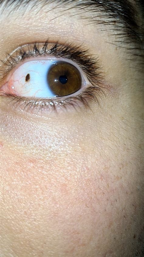 i have a freckle on my eye : r/mildlyinteresting