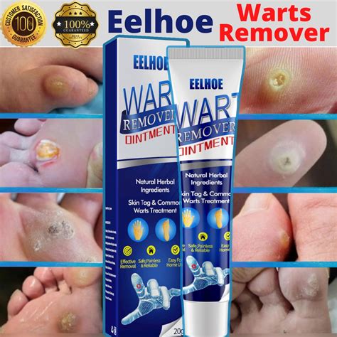 1box 60g New Upgrade Wart Cream Treat Skin Tag Mole Calluses Acne Ointment Antibacterial Foot ...