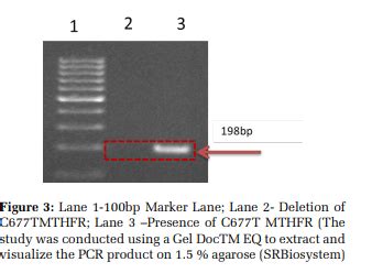 Association of MTHFR Gene Polymorphism with Hyper - Homocysteinemia and ...