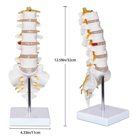 NLShan Scientific Lumbar Spine Model with 5 India | Ubuy