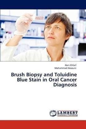 Brush Biopsy and Toluidine Blue Stain in Oral Cancer Diagnosis: Buy ...
