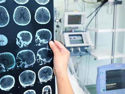 Electroencephalogram (EEG) Test in India | Clinic Consultation